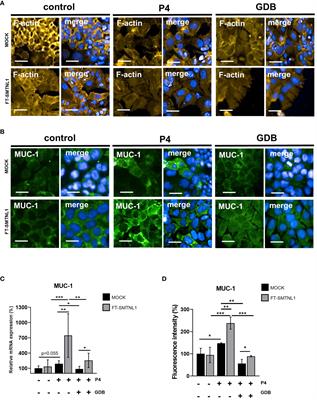 Smoothelin-like protein 1 promotes insulin sensitivity and modulates the contractile properties of endometrial epithelial cells with insulin resistance